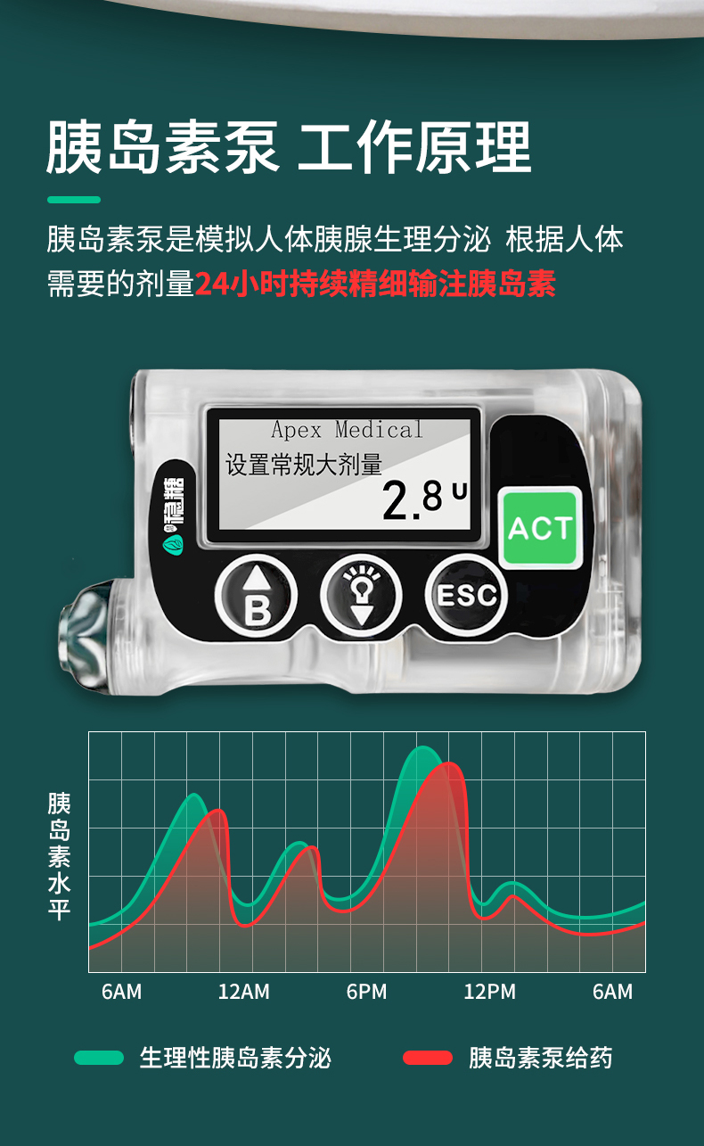 最新全自動胰島素泵，糖尿病管理的革命性進步，全自動胰島素泵，糖尿病管理的突破性革新