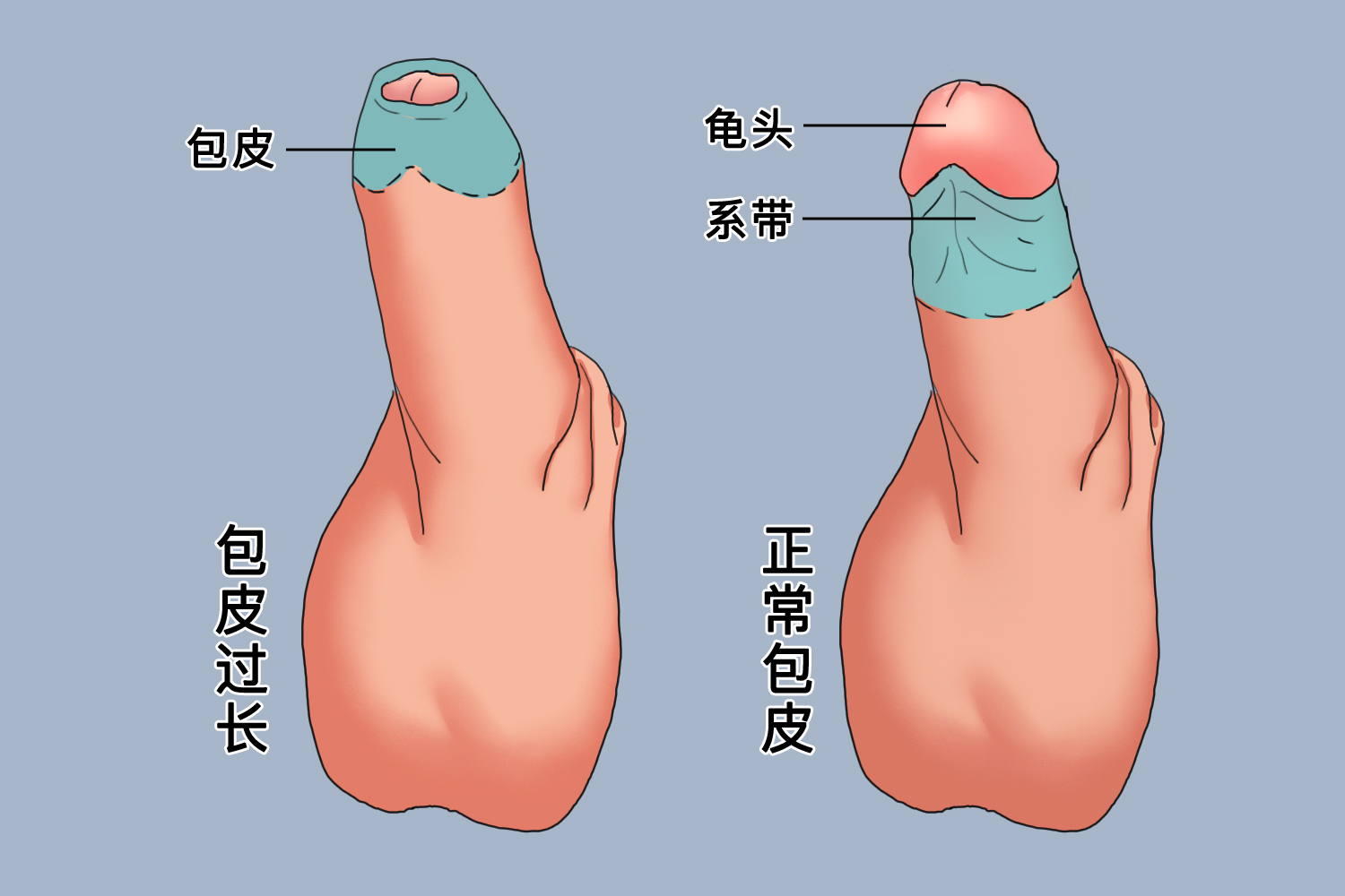 探索男性生理奧秘，包皮的正常形態(tài)解析，男性生理奧秘探索，包皮正常形態(tài)解析