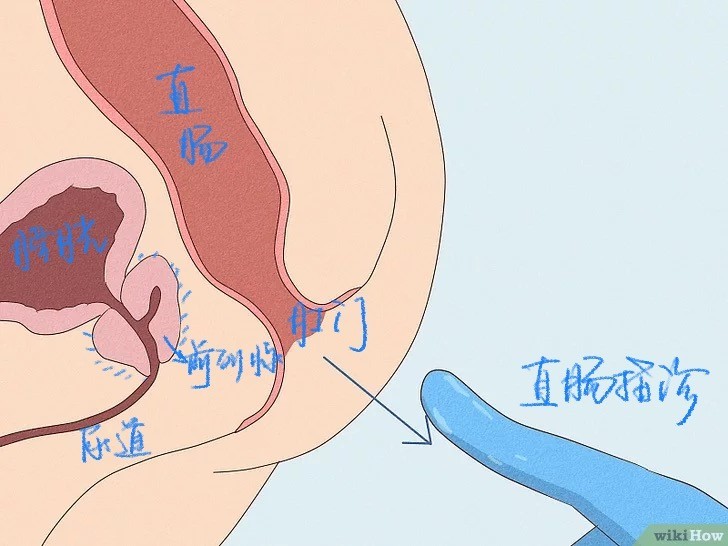 前列腺按摩的正確方法