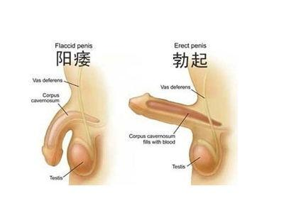 前列腺炎的治療與藥物治療方案，前列腺炎的治療及藥物治療方案詳解