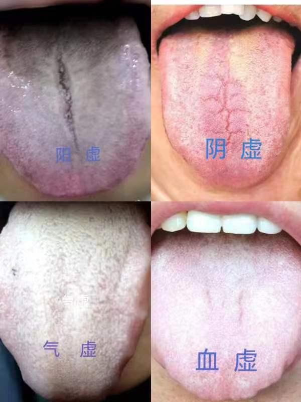 男性腎陽(yáng)虛的癥狀及其影響，男性腎陽(yáng)虛癥狀與影響概述