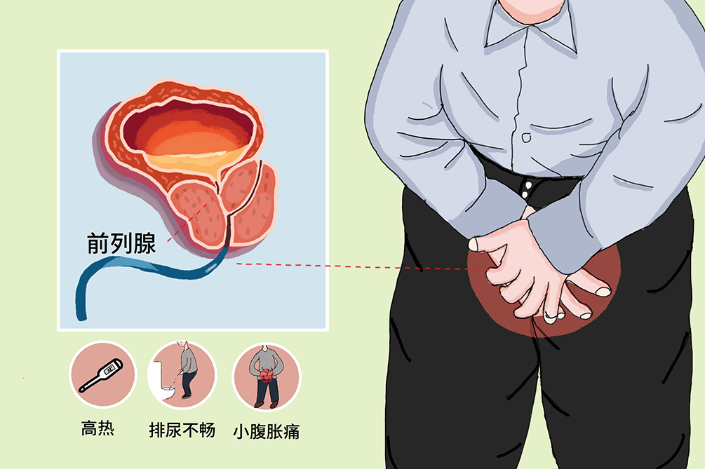 前列腺炎的緩解方法，了解、預(yù)防與改善，前列腺炎緩解方法，了解、預(yù)防與改善措施